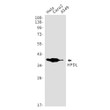 HPDL antibody western blot HeLa Caco2 A549 STJA0034435