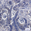 IDH2 antibody immunohistochemistry human colon cancer paraffin STJA0034452