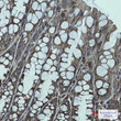 IGF2BP1 antibody immunohistochemistry mouse colon STJA0034456