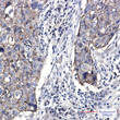 Junctional Adhesion Molecule 1 antibody immunohistochemistry human lung cancer STJA0034496