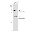 Mesothelin antibody western blot 3T3 mouse lung STJA0034559