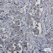 c-Met antibody immunohistochemistry human lung cancer STJA0034560