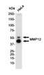 MMP12 antibody western blot HeLa lysates STJA0034573