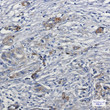 MYO1B antibody immunohistochemistry human lung cancer STJA0034602