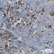 NXF1 antibody immunohistochemistry human breast cancer tissue STJA0034661