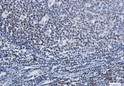 PARP1 antibody immunohistochemistry human tonsil paraffin-embedded STJA0034689