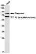 PCSK9 antibody western blot HeLa lysates STJA0034697