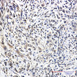 Pin1 antibody immunohistochemistry human breast cancer paraffin-embedded STJA0034725
