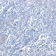 PKA R2 Phospho-Ser99 antibody immunohistochemistry human tonsil STJA0034728