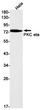 PKC eta antibody western blot HeLa lysates STJA0034732