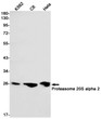 Proteasome 20S alpha 2 antibody western blot K562 C6 HeLa STJA0034758