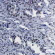 RbAp48 antibody immunohistochemistry human lung cancer STJA0034806