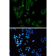 RENT1 antibody immunocytochemistry HeLa cells STJA0034811