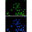 Retinoid X Receptor alpha antibody immunocytochemistry MCF-7 STJA0034813
