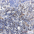 S100A4 antibody immunohistochemistry human lung cancer tissue STJA0034835