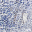 SCAI antibody immunohistochemistry human lung cancer STJA0034841