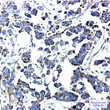 TXNRD2 antibody immunohistochemistry human cholangiocarcinoma STJA0034968