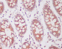 Phospho-SIRT1 S47 antibody immunohistochemistry human colon STJA0036024