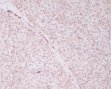 PRP19 antibody immunohistochemistry human cervix cancer STJA0036035
