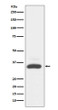 MAD2L1BP antibody western blot A431 cells STJA0036040
