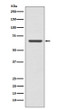 CPT2 antibody western blot MCF-7 cells STJA0036051