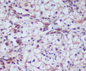 CD13 antibody immunohistochemistry human kidney STJA0036071