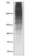 MUC16 antibody western blot human ovarian cancer STJA0036072