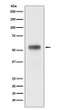 Retinoic Acid Receptor alpha antibody western blot MCF-7 STJA0036083