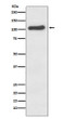 ACE2 antibody western blot human kidney STJA0036101