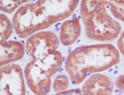PDPK1 antibody immunohistochemistry human kidney STJA0036128