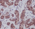 STAT5A/B antibody immunohistochemistry human breast STJA0036151