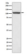 Hsp110 antibody western blot HeLa lysates STJA0036195
