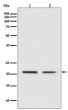 CDC42 antibody western blot Jurkat mouse spleen STJA0036201