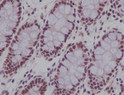 CDCA5 antibody immunohistochemistry human colon STJA0036203