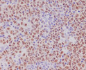 PAX5 antibody immunohistochemistry human tonsil STJA0036211