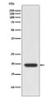 CD3D antibody western blot Jurkat lysates STJA0036216