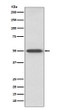 RAGE antibody western blot mouse lung lysates STJA0036265