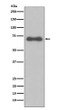 NUMB antibody western blot Ramos lysates STJA0036294