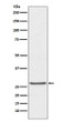 TIMP1 antibody western blot human prostate cancer STJA0036313