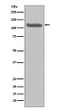 FGFR3 antibody western blot HeLa lysates STJA0036338
