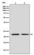 FGF21 antibody western blot HeLa mouse spleen STJA0036350