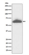 RPE65 antibody western blot mouse eyeball STJA0036394