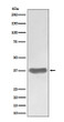 SFRP1 antibody western blot A375 lysates STJA0036397
