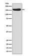 CD163 antibody western blot human fetal kidney STJA0036401