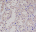 S100 antibody immunohistochemistry human kidney STJA0036404