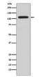 NFAT2 antibody western blot Ramos STJA0036408