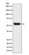 Lipoprotein lipase antibody western blot human fetal liver STJA0036412
