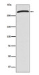 CHD4 antibody western blot 293T cells STJA0036423