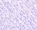 EAAT1 antibody immunohistochemistry human brain STJA0036424
