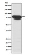 PIAS1/2 antibody western blot HepG2 lysates STJA0036425